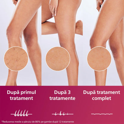 Epilator IPL PHILIPS Lumea Prestige Seria 8000 BRI947/00, 450.000 de impulsuri, 4 accesorii, senzor SmartSkin, GARANTIE 5 ANI