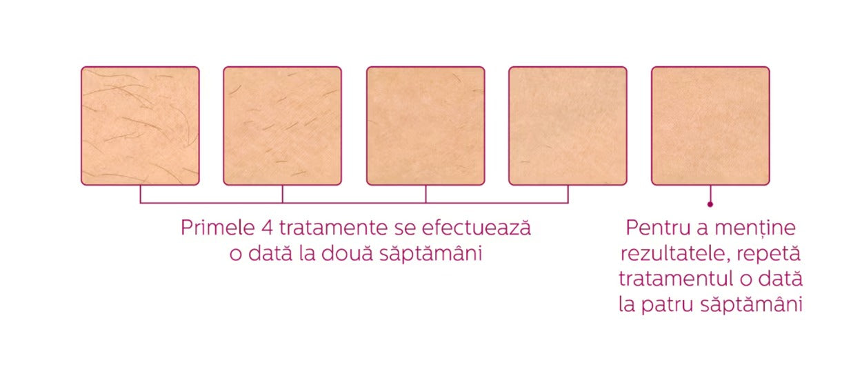 Epilator IPL PHILIPS Lumea Prestige Seria 8000 BRI947/00, 450.000 de impulsuri, 4 accesorii, senzor SmartSkin, GARANTIE 5 ANI