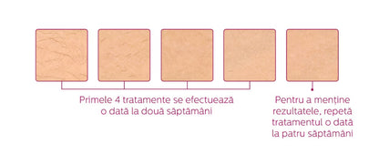 Epilator IPL PHILIPS Lumea Prestige Seria 8000 BRI947/00, 450.000 de impulsuri, 4 accesorii, senzor SmartSkin, GARANTIE 5 ANI